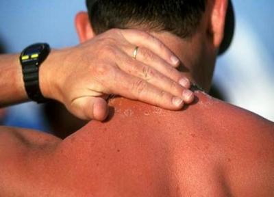 کدام قسمت های بدن از آفتاب سوختگی مصون نمی مانند؟